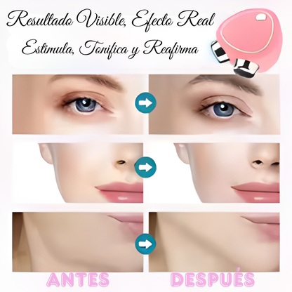 Masajeador Facial Microcorriente – Reafirma, Levanta y Rejuvenece